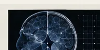 Visualisation scientifique d'un cerveau
